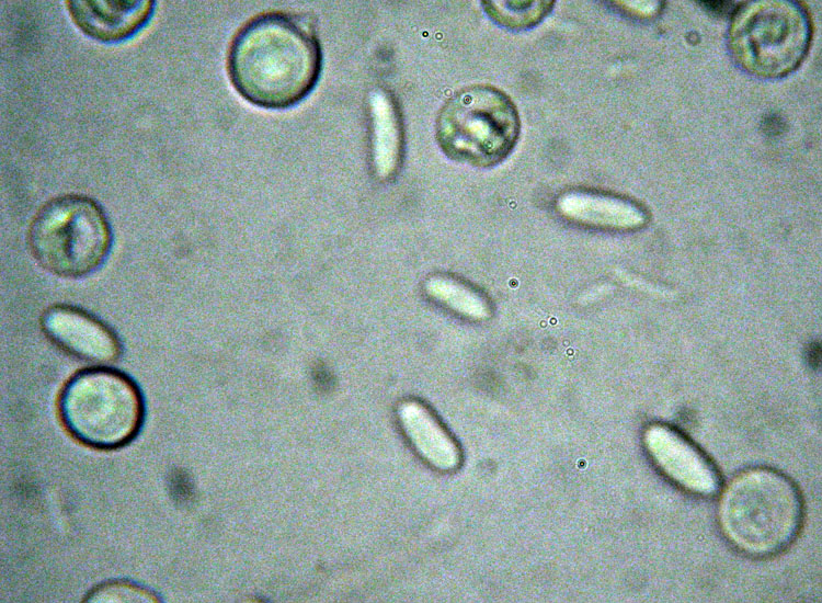 In parcheggio (Granulobasidium vellereum)